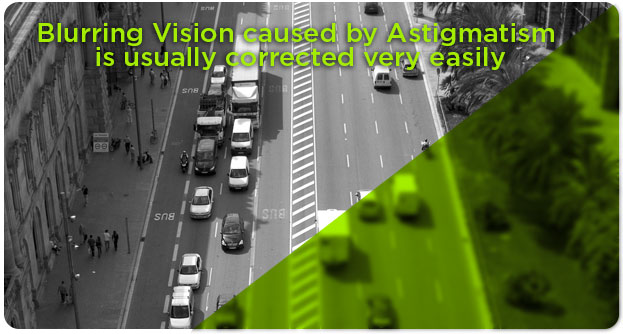 Astigmatism