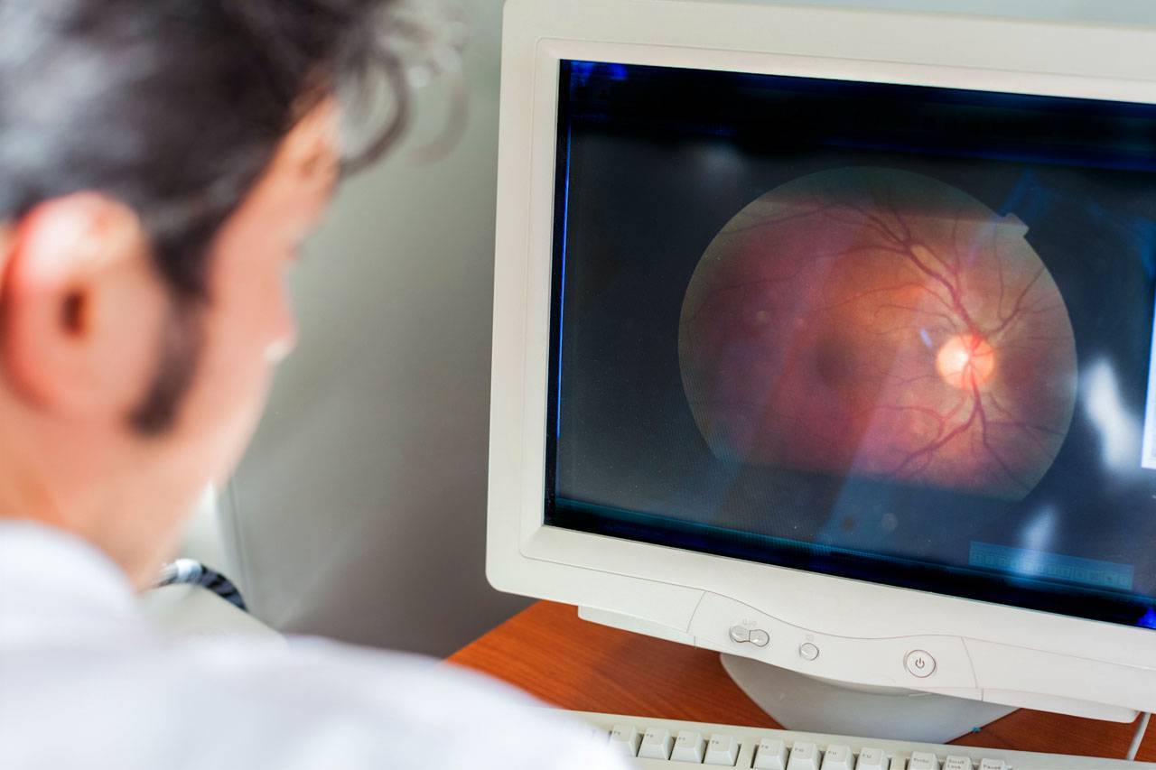 Optical Coherence Tomography 